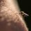 🗣️ 5 нижегородцев с начала этого года подцепили червей после укуса комара.

Это называется дирофиляриоз —..