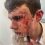 Конфликт в школьной столовой в Сергиевом Посаде закончился кровопролитием

Один из подростков вылил..