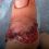 В Ростове хирурги пришили средний палец 13-летней школьнице. Подросток нечаянно оторвала конечность во время..