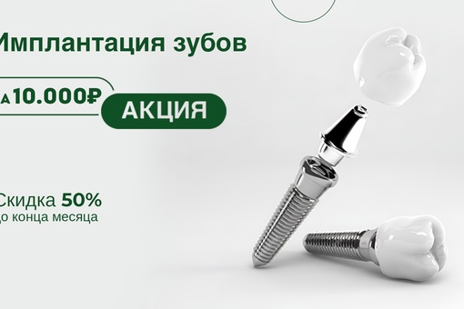 Протезирование зубов на имплантах за 1 день. Стоматология Екатеринбурга - нам доверяют. Пожизненная..