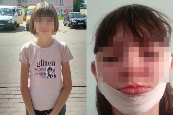 Девочка из Новосибирской области, которую ударил школьник по голове, проходит реабилитацию

— Инцидент..