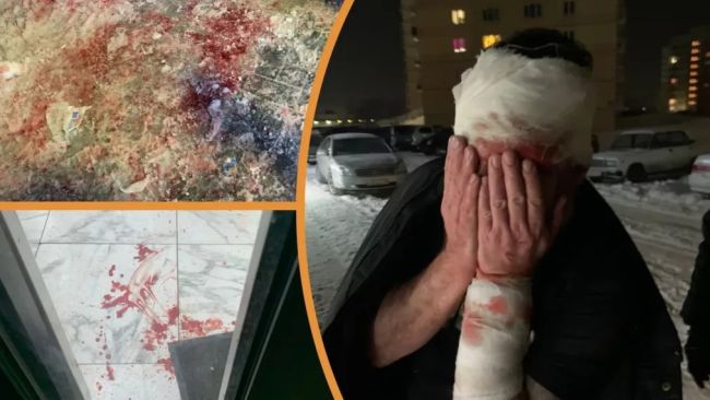 Мужчина нанёс не менее шести резаных ран сибиряку

В Кировском районе Новосибирска в местном алкомаркете..