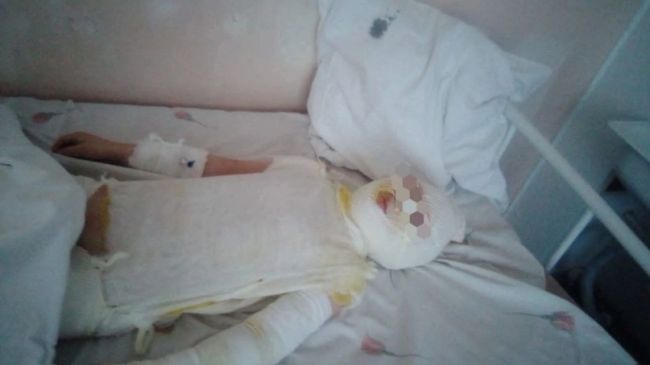 🙏🏻В Башкирии врачам удалось стабилизировать состояние ребенка с жуткими ожогами 
 
Врачам..