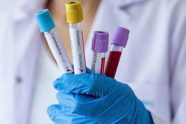 В Самарской области 560 новых заболевших коронавирусом за неделю 

По данным оперштаба страны, с 22 по 28 апреля..