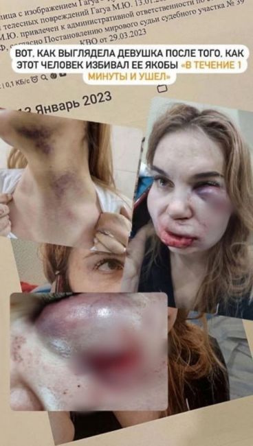 В Краснодаре избитая мать двоих детей жалуется, что полиция не возбуждает уголовное дело на ее..