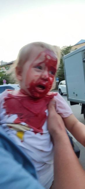 В Крыму дочь местного депутата сбила на самокате ребенка в парке, после чего поехала кататься..