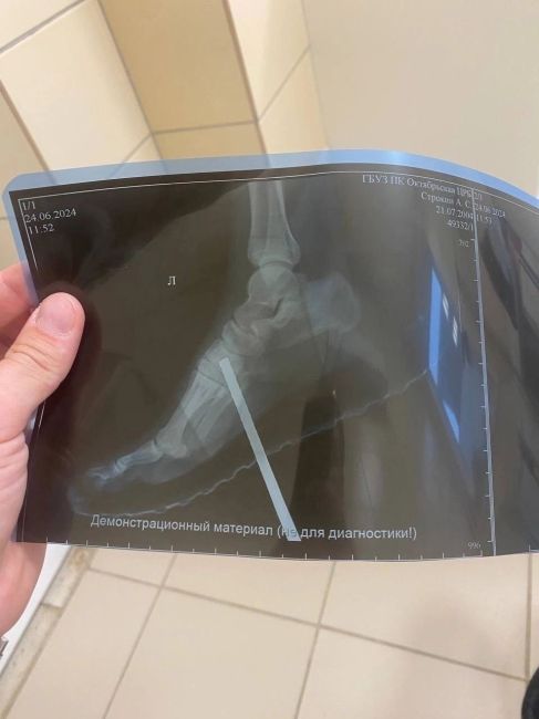 Житель Тюмени получил травму ноги, выйдя на станции Чад в Пермском крае. Инцидент произошел 24 июня, когда..