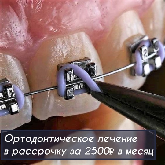 Стоматология Эмидент vk.com/stomatologia_ufa 8-917-368-03-95 
Снимок всех зубов (КТ)+ Консультация врача= за 0 ₽ (Бесплатно) 
..